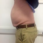 The Cheshire Aeshetic Clinic Chester | Laser Lipo Inch Loss and Fat Reduction | Man's stomach before